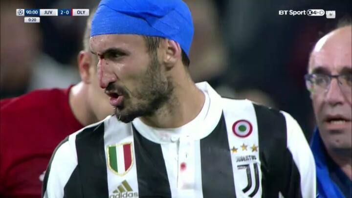 chiellini juve