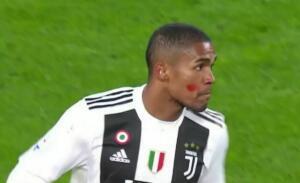 douglas costa juventus atletico