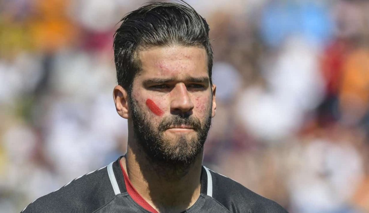 Alisson con la maglia della Roma - Foto Lapresse - Jmania.it